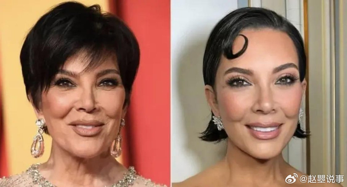 卡戴珊家族掌门人克里斯·詹娜拉皮手术效果一年后下滑