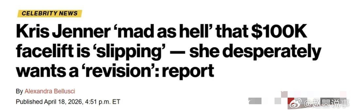 肯达尔詹娜卡戴珊_詹娜卡戴珊_