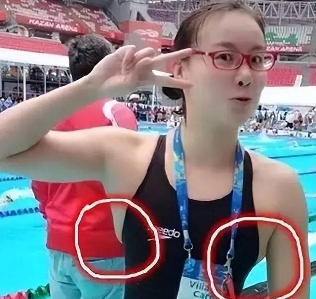 _隐私毛可以剪掉吗_隐私的部位毛发能剪吗