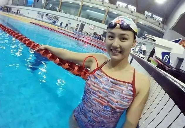 隐私的部位毛发能剪吗_隐私毛能剪掉吗_